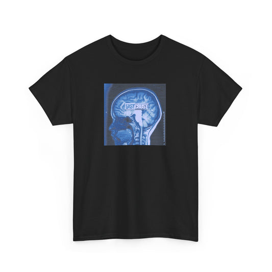EC - Skull Examination