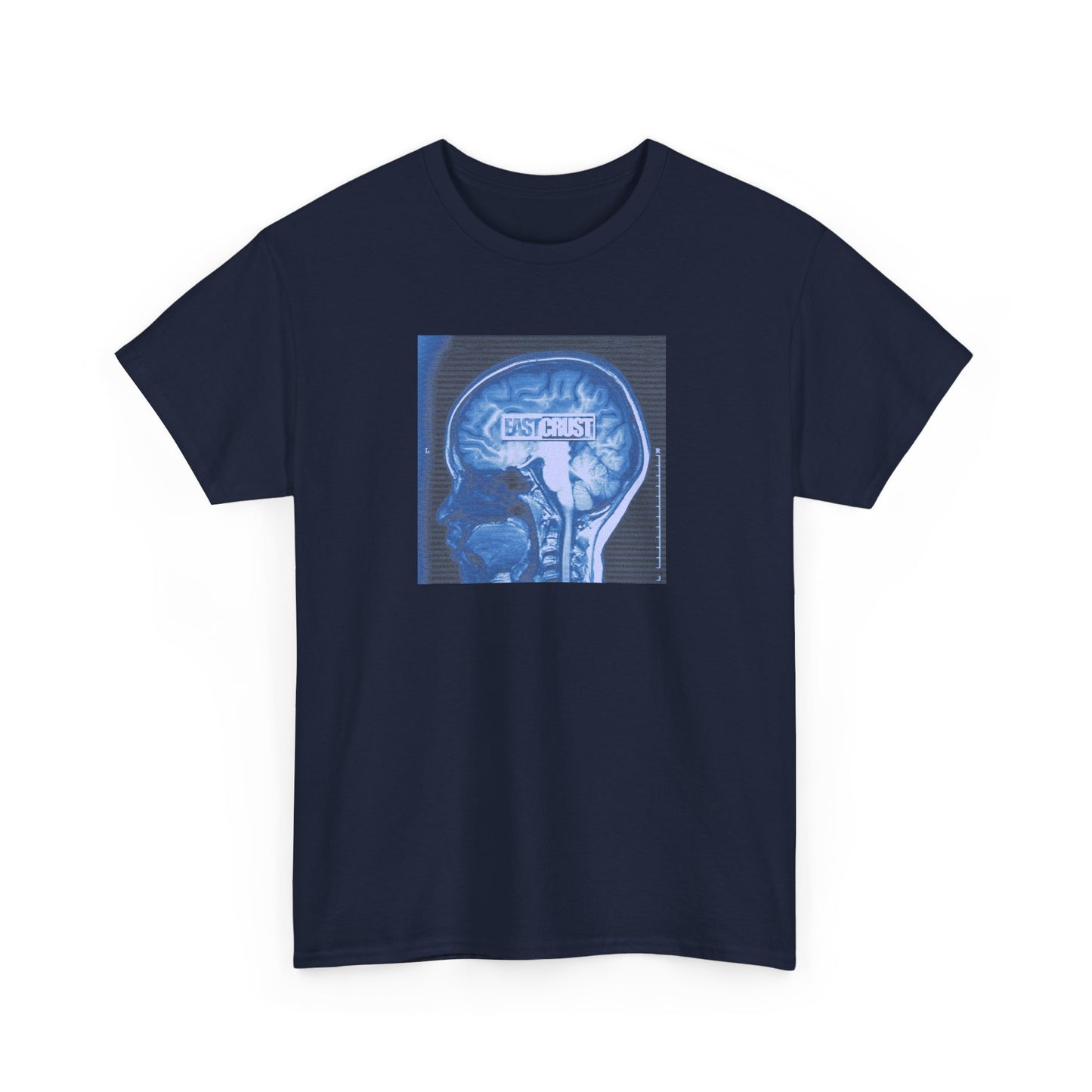 EC - Skull Examination